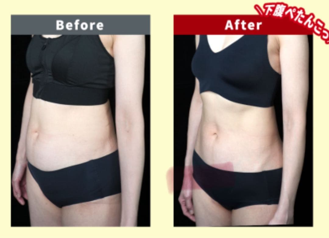 即ヤセ!! 激痩せ!!皮下脂肪溶解 カベリン!!残り1セットのみ☆5ボトルセット