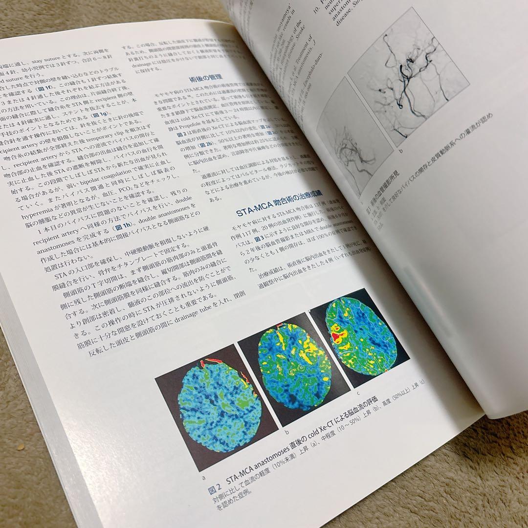 脳神経外科 UpToDate