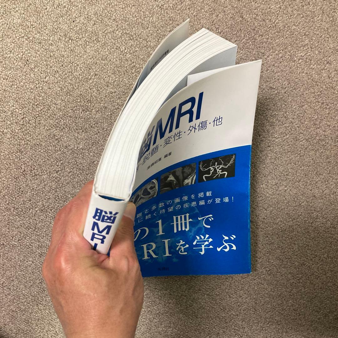 脳MRI 2 代謝・脱髄・変性・外傷・他