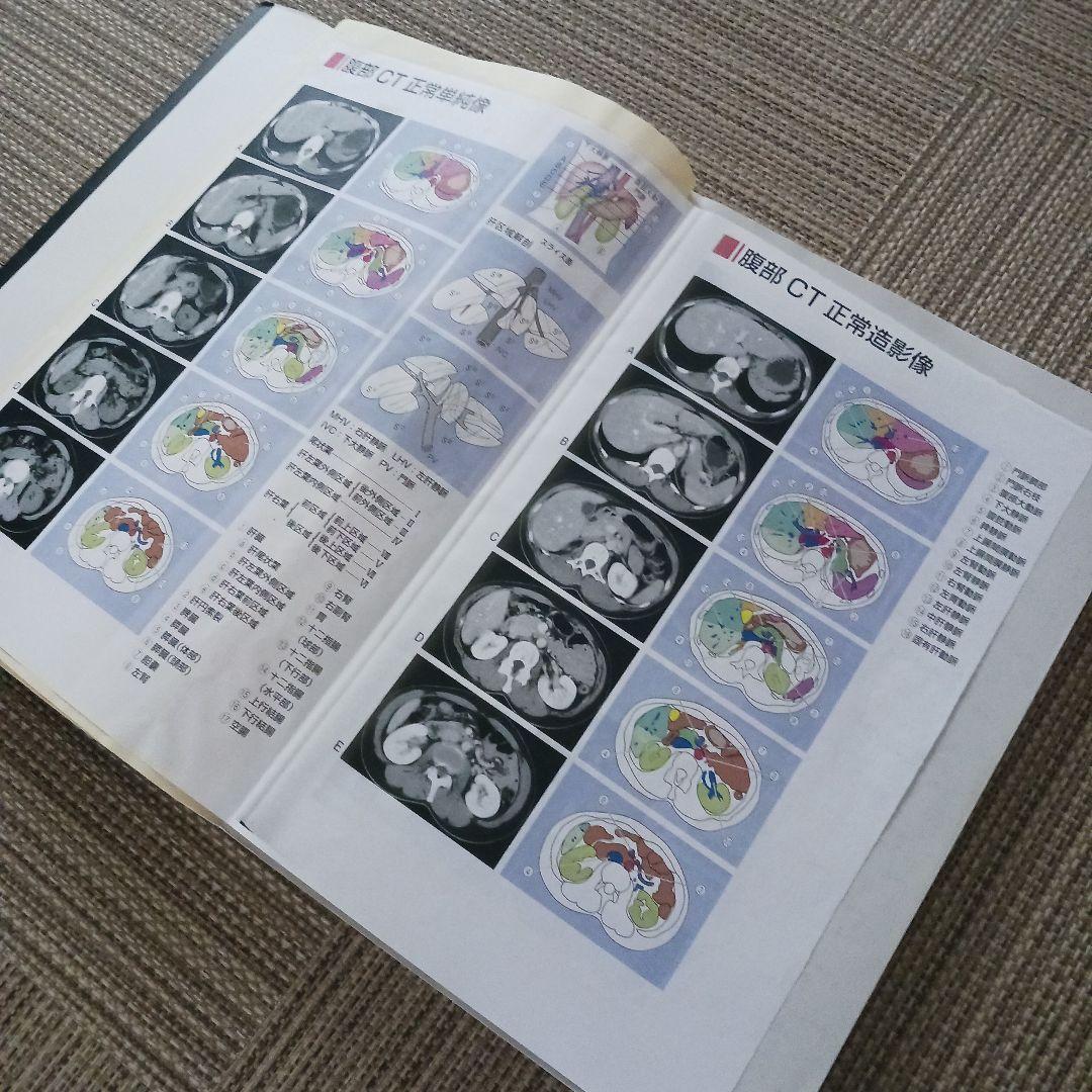 腹部超音波テキスト : 上・下腹部　腹部エコー　参考書　ベクトル・コア