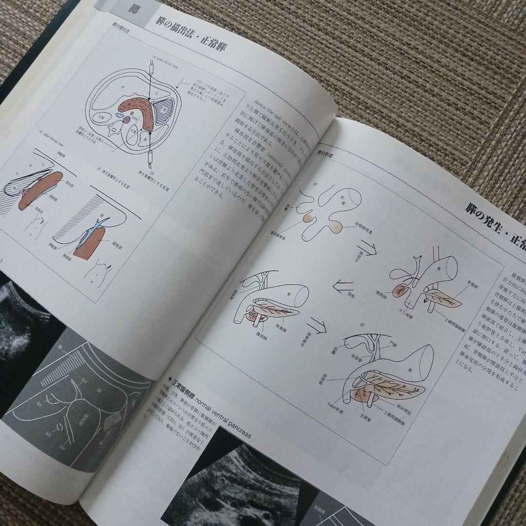腹部超音波テキスト : 上・下腹部　腹部エコー　参考書　ベクトル・コア