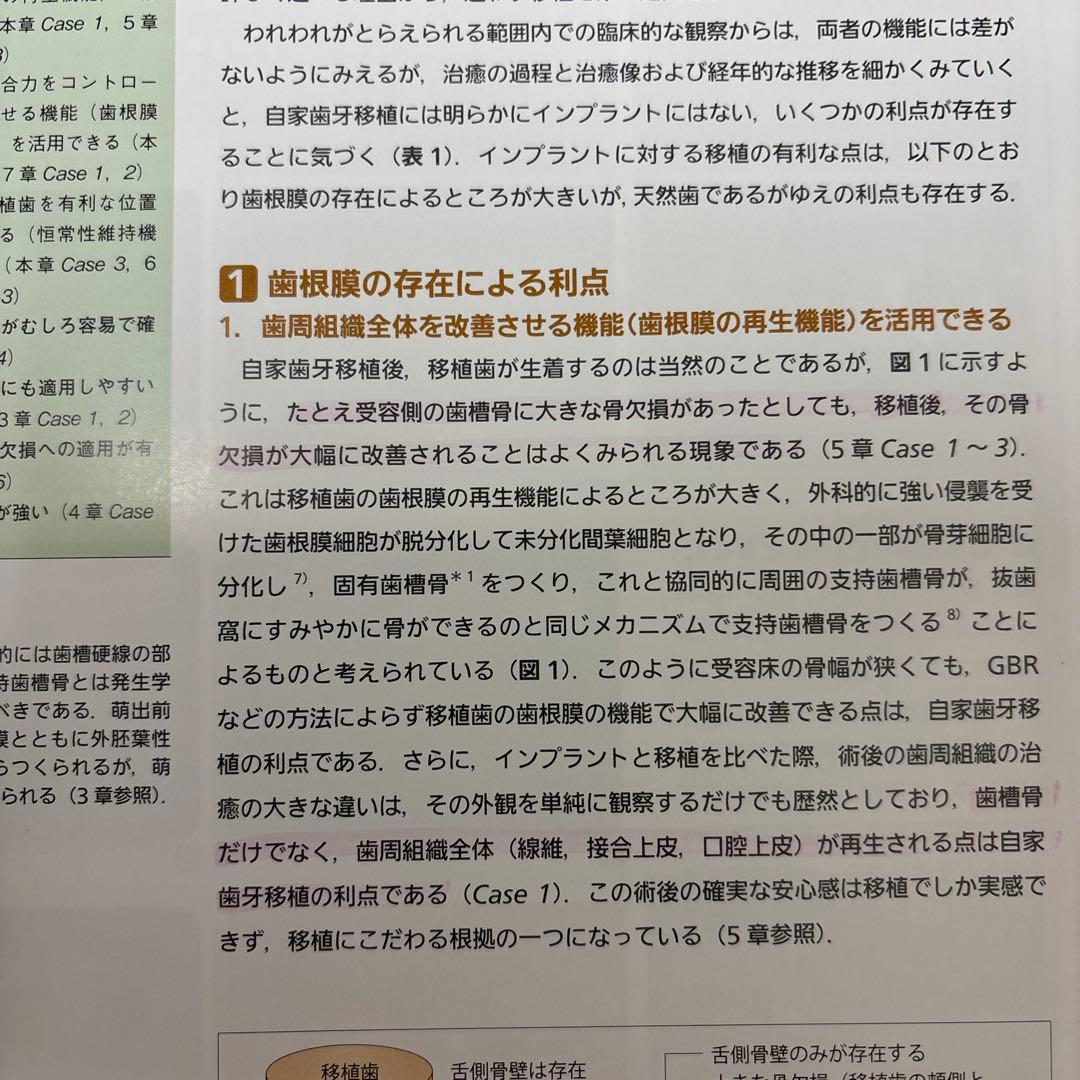 歯根膜による再生治療 : インプラントを考える前に