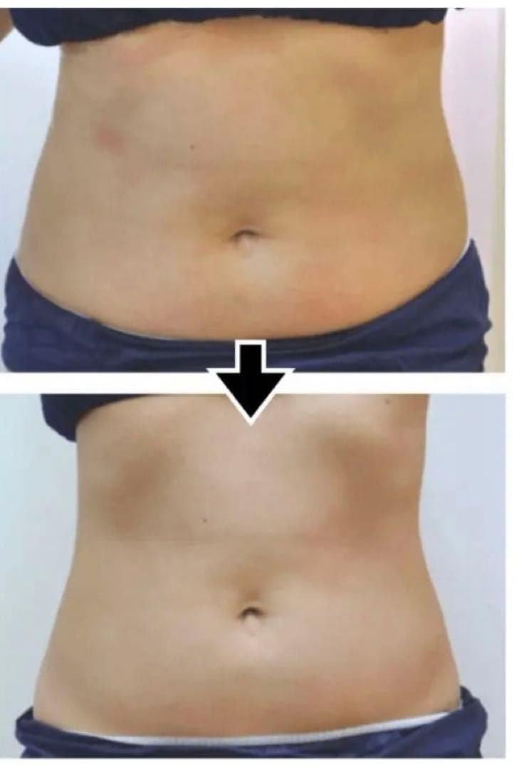 値下げ　じぶんdeエステ　セルゼロファスト　痩身　ダイエット