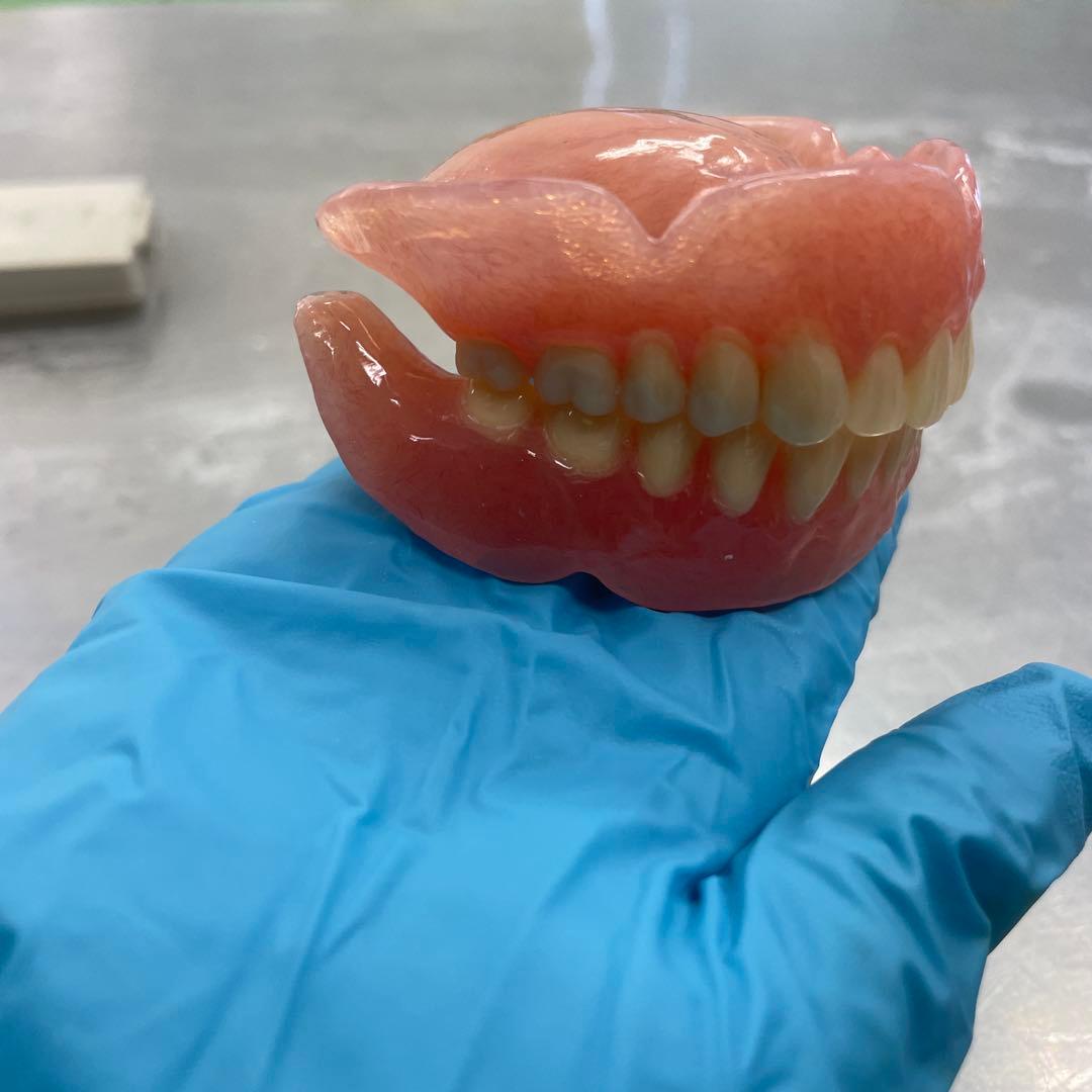 義歯　見本　総義歯 入れ歯 全部床義歯 歯科 ばんばんざい義歯
