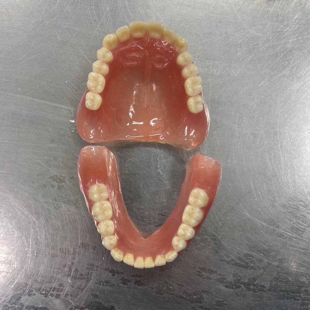 義歯　見本　総義歯 入れ歯 全部床義歯 歯科 ばんばんざい義歯