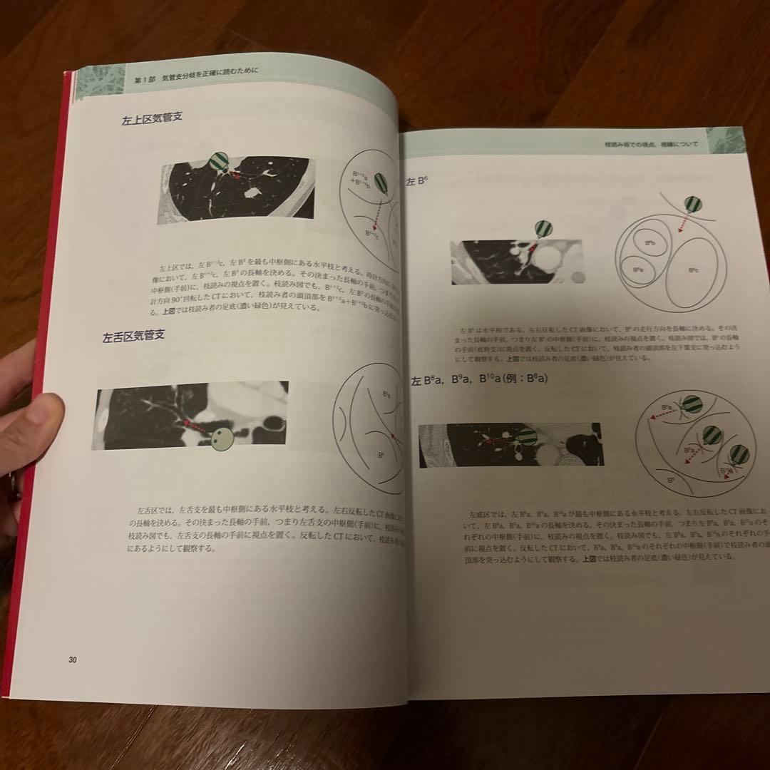 末梢病変を捉える気管支鏡\"枝読み\"術