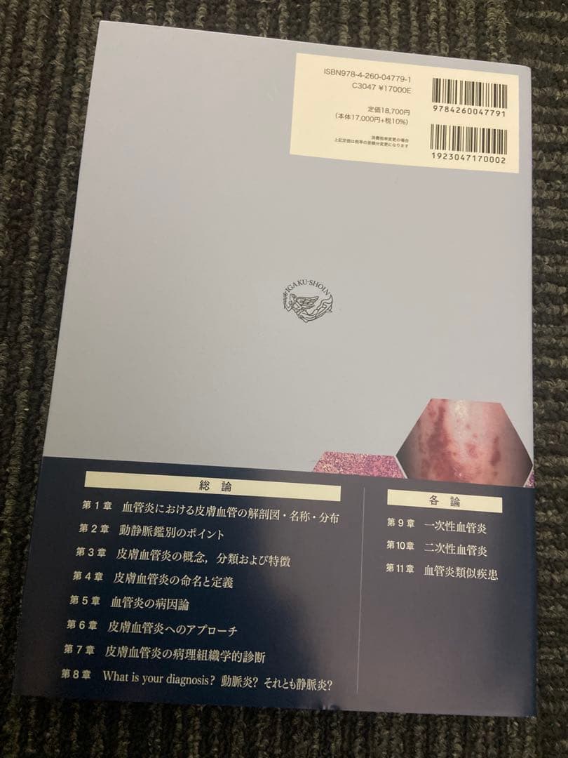 皮膚血管炎 第2版