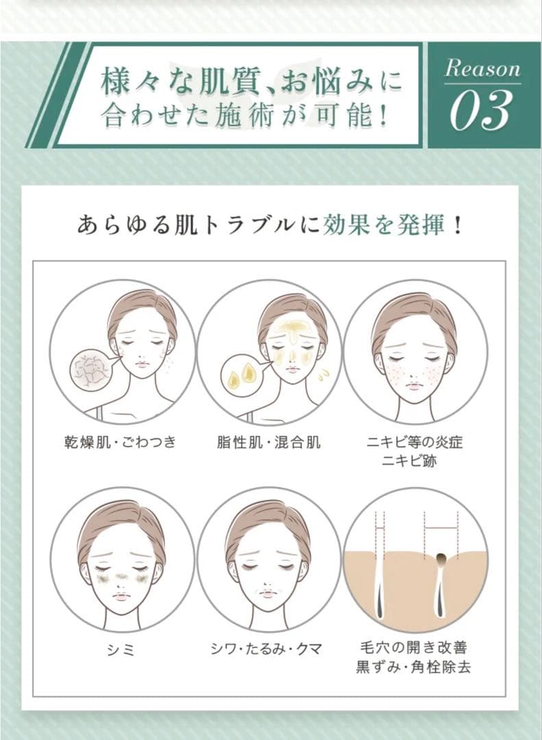 プロノビセア ハーブピーリングセット 剥離なし ダウンタイムなし