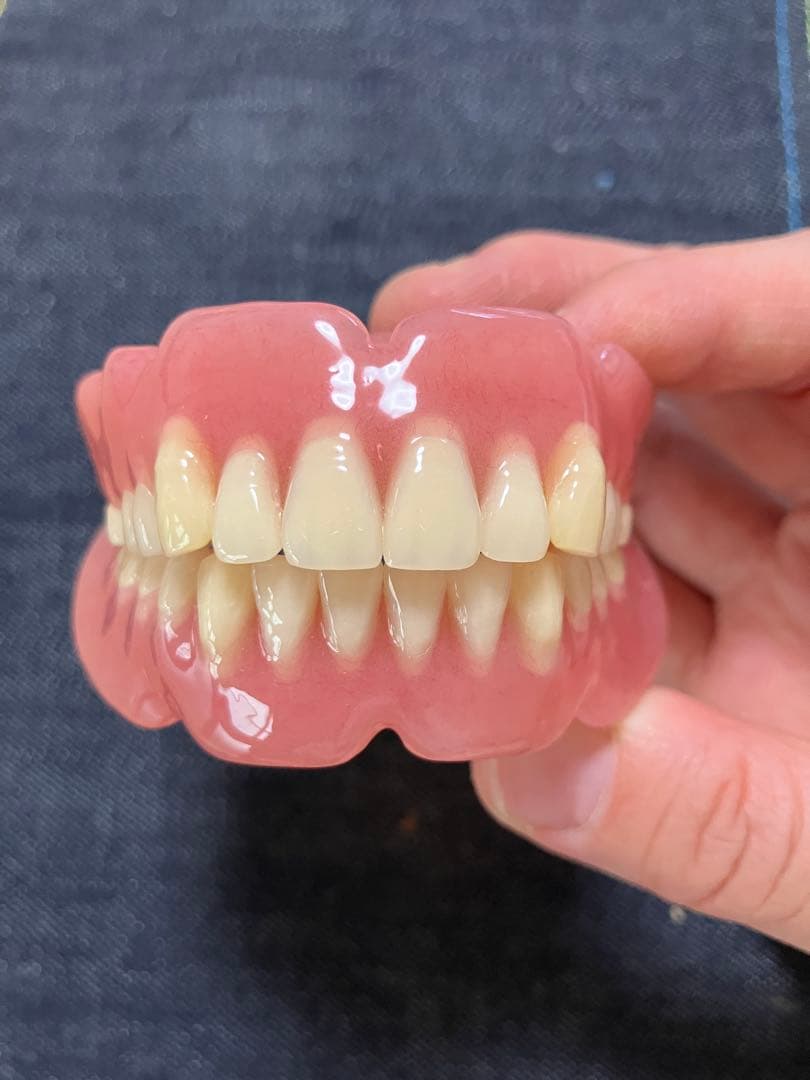 歯科 技工 フルデンチャー