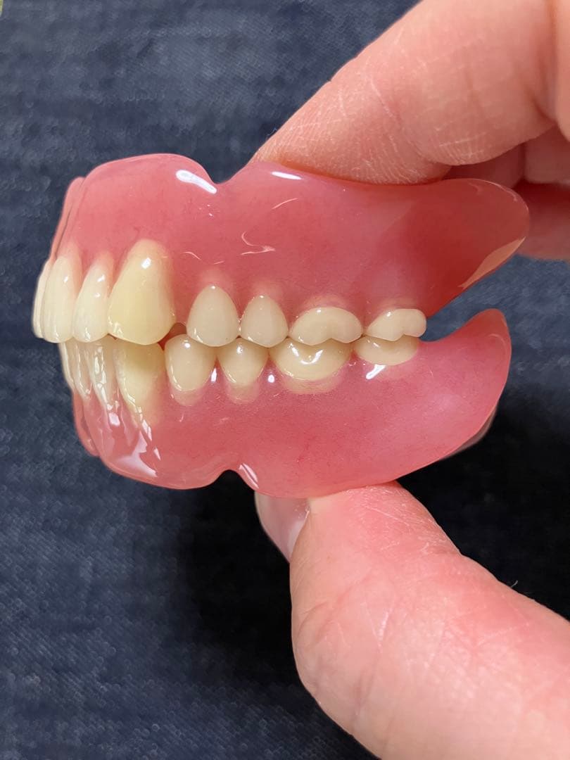 歯科 技工 フルデンチャー