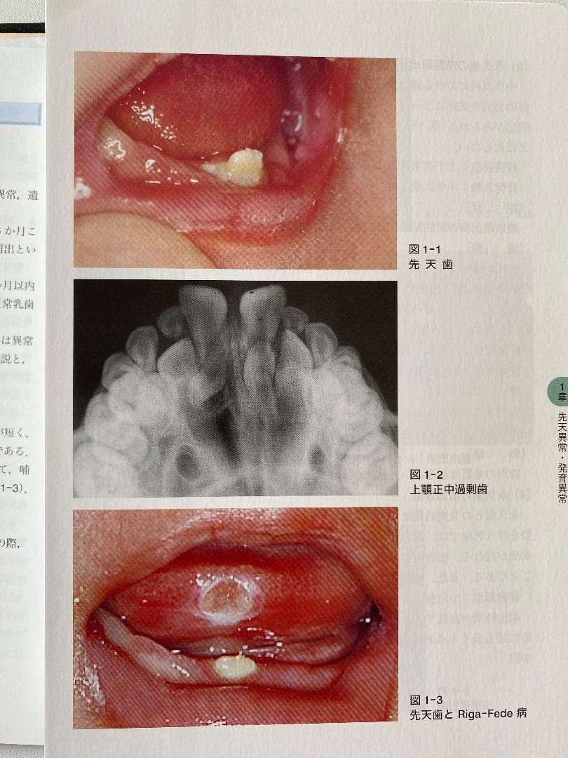 サクシンクト 口腔外科学 第4版【裁断済み】