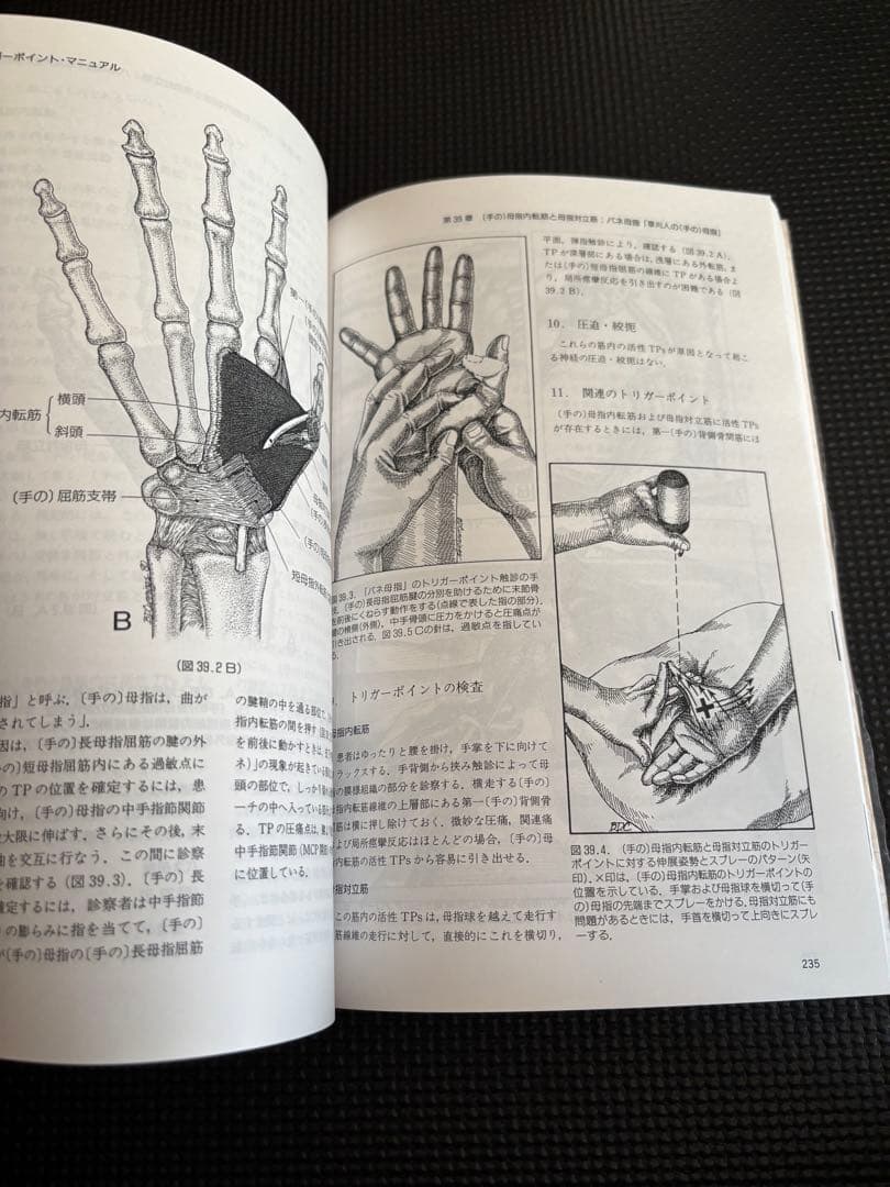 トリガーポイント・マニュアル 第Ⅱ巻　美品