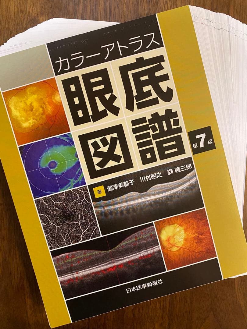 眼底図譜 カラーアトラス　【裁断済み】