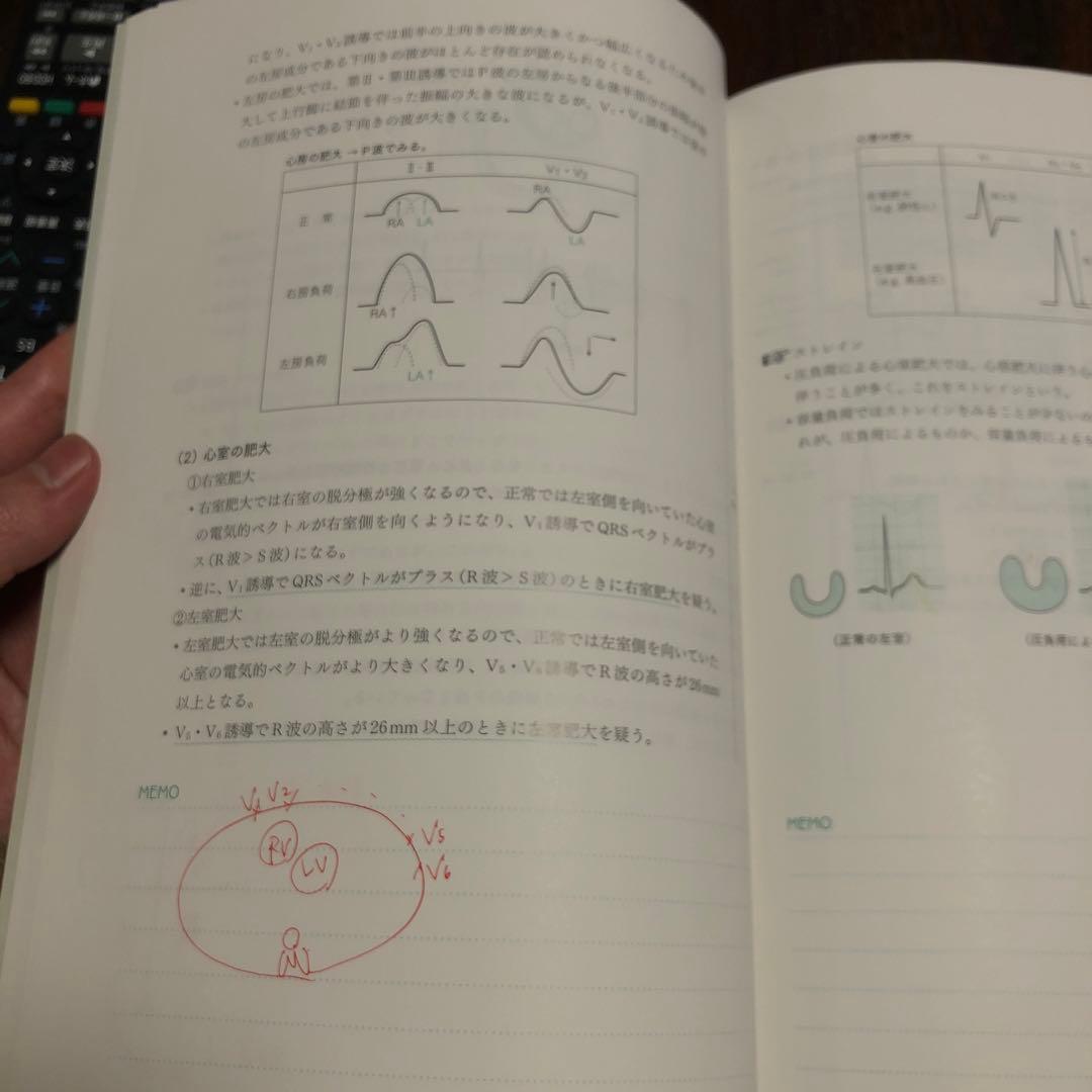 心電図 : 臨床の現場で活きる基礎知識 : Dr.東田の「名物講義」実況中継