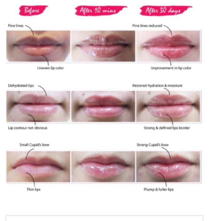 リップグロス Lipaddict 213 203 208