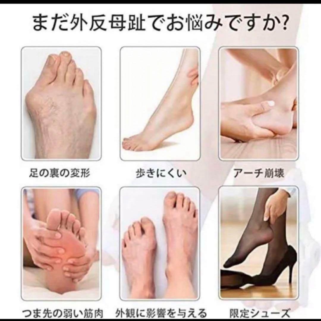 母趾 足指サポーター 外反母趾 サポーター 男女兼用 ベージュ フリーサイズ