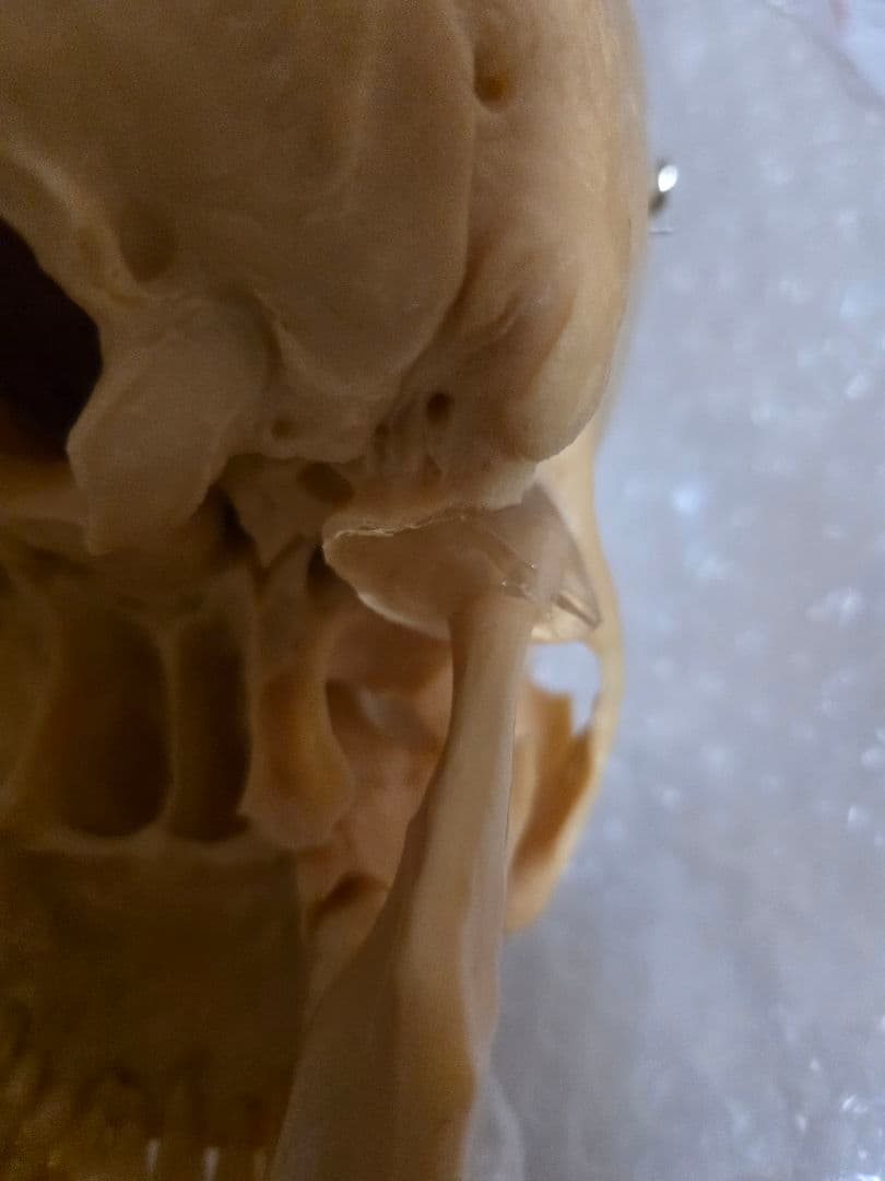 NISSIN DENTAL 頭 歯 模型 アンティーク ガイコツ