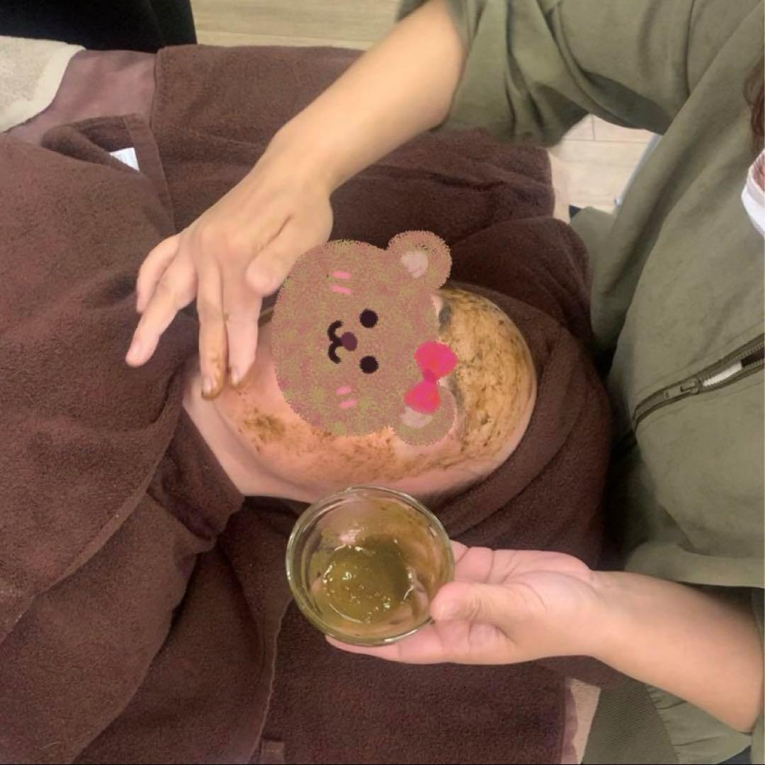 ハーブピーリング剥離無し　10回分　（11月11日から2月20日の間発送停止)