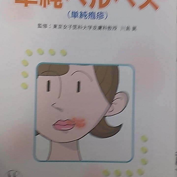 単純ヘルペスについての本