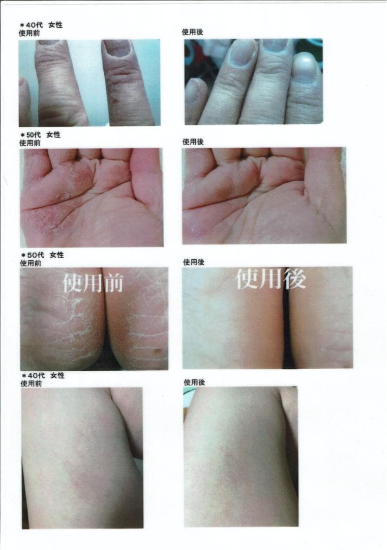 【新品4個】PharmaS1 ファルマS1 シコニンクリーム ノンステロイド