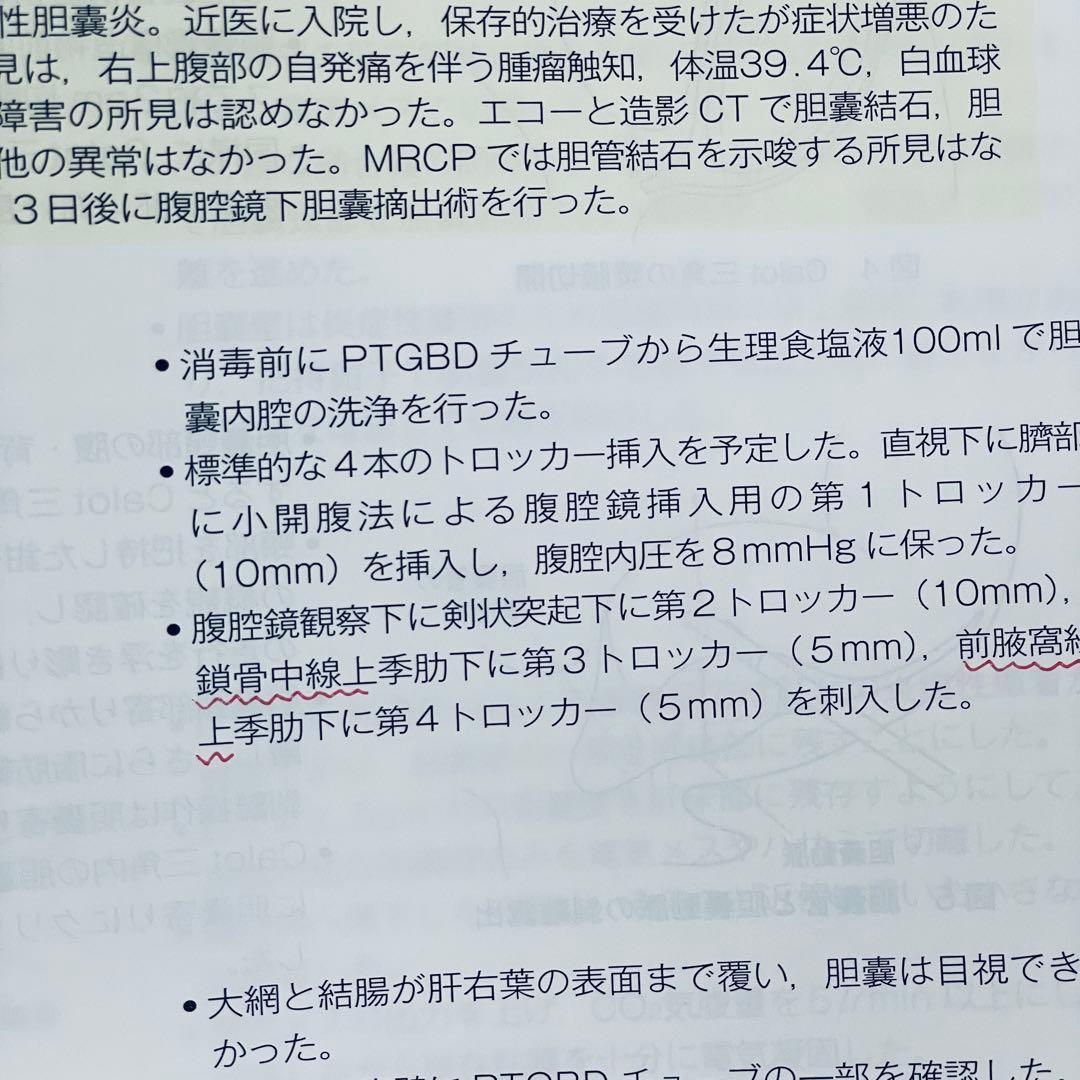 消化器外科　手術記録の書き方 Vol.37 No.5 2014年4月号