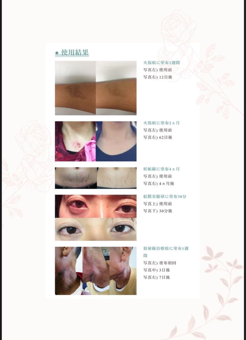 SILVER SPACE フェイスクリーム