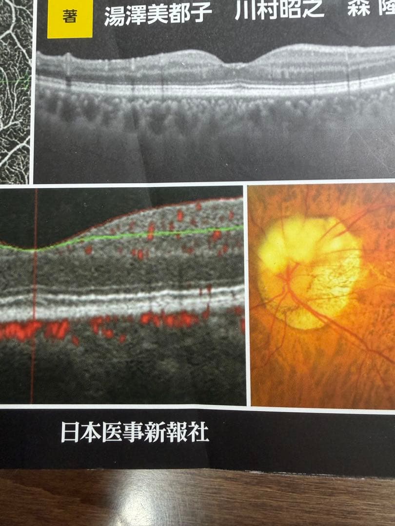 カラーアトラス 眼底図譜 第7版