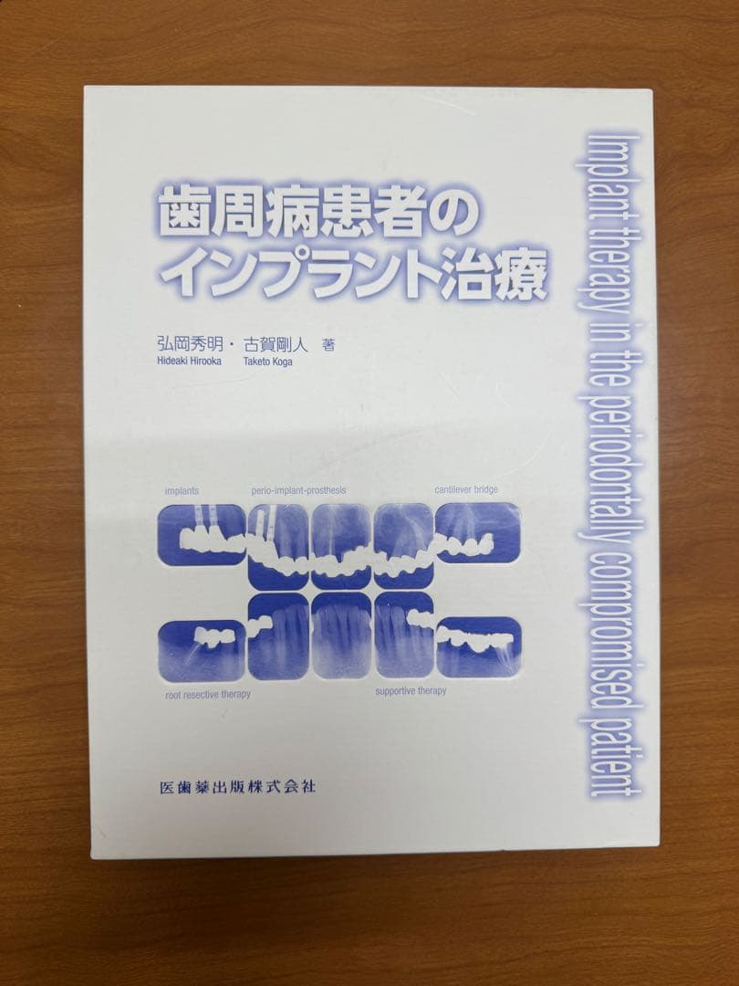 歯周病患者のインプラント治療