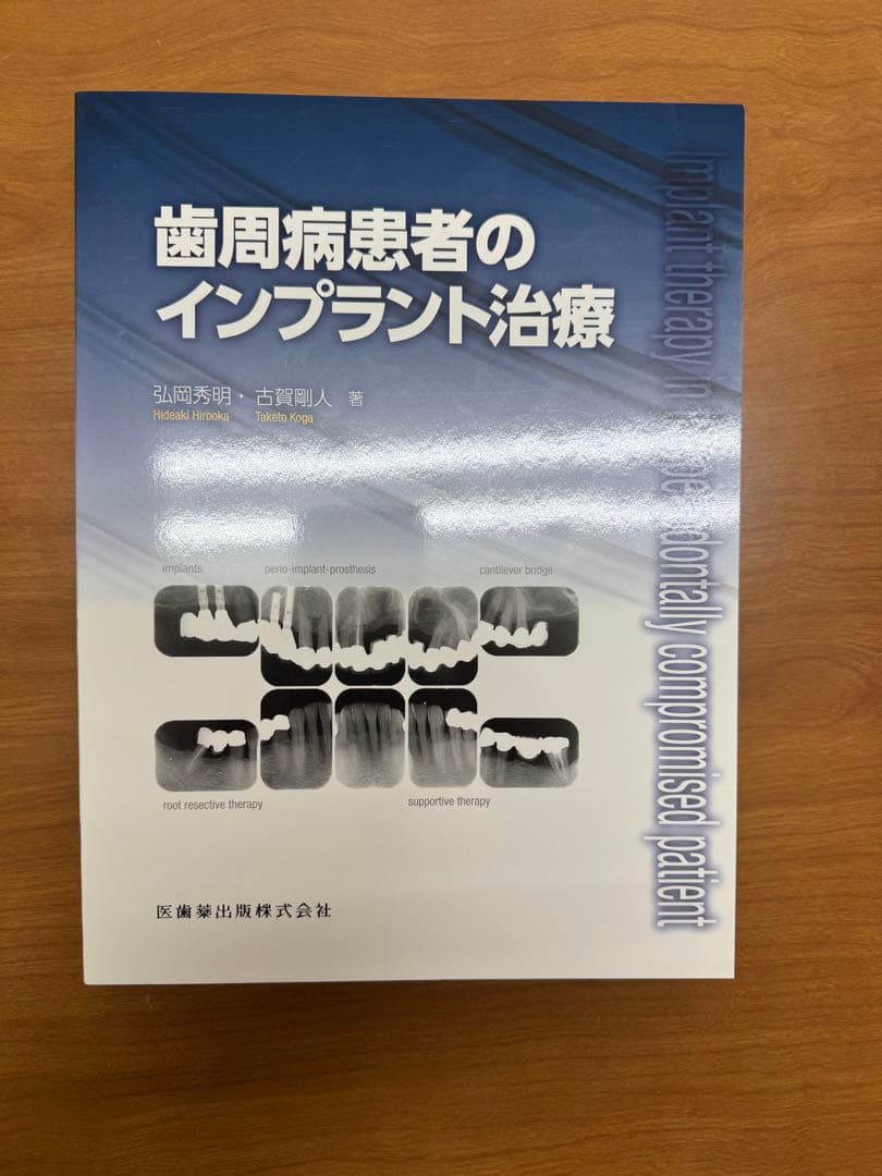 歯周病患者のインプラント治療