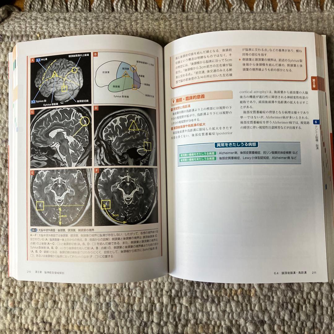 脳神経 画像解剖 ナビゲーション