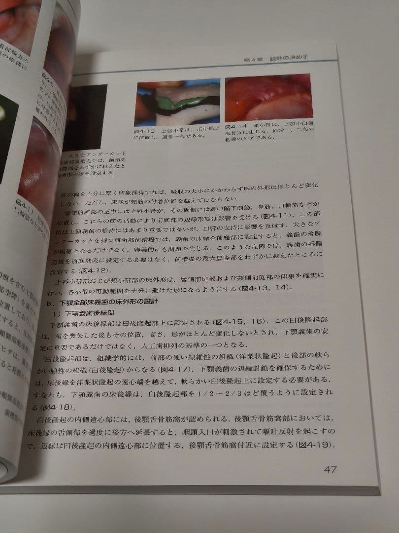 有床義歯臨床ヒント集 カラーアトラス クインテッセンス出版 歯科専門書