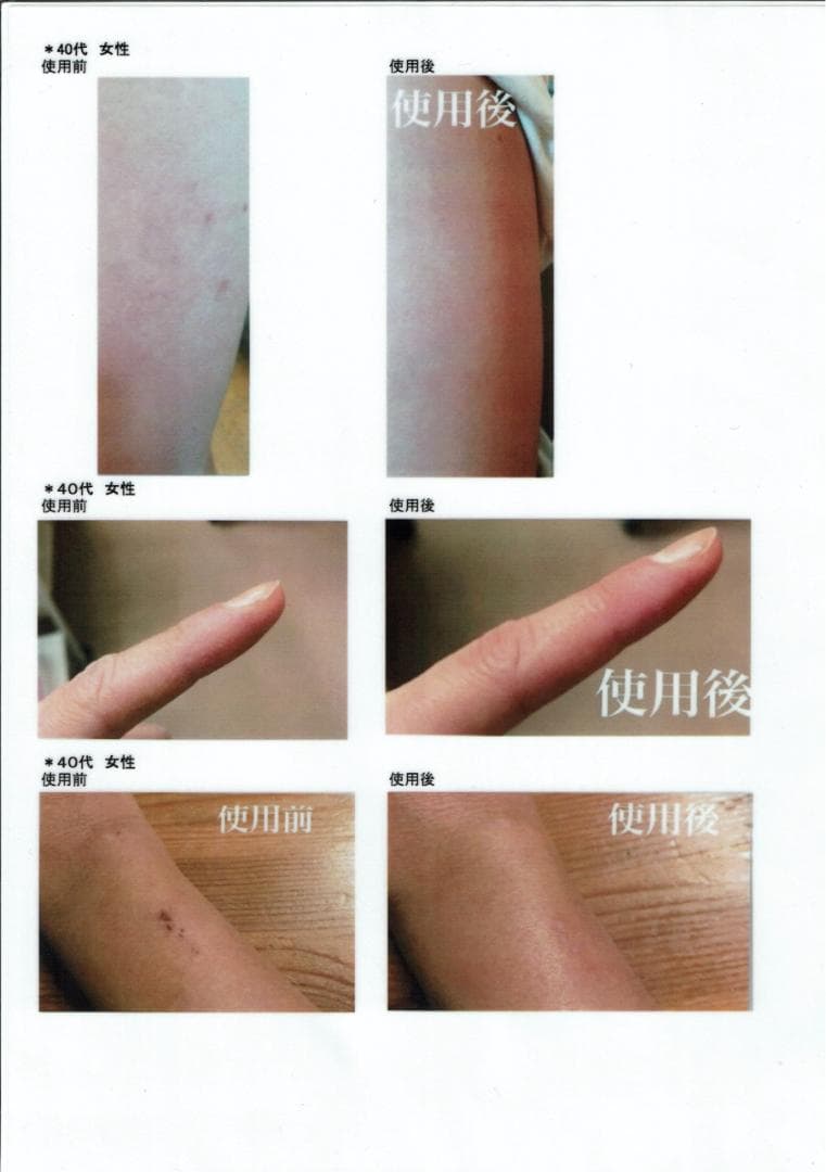 【新品10個】PharmaS1 ファルマS1 シコニンクリーム ノンステロイド