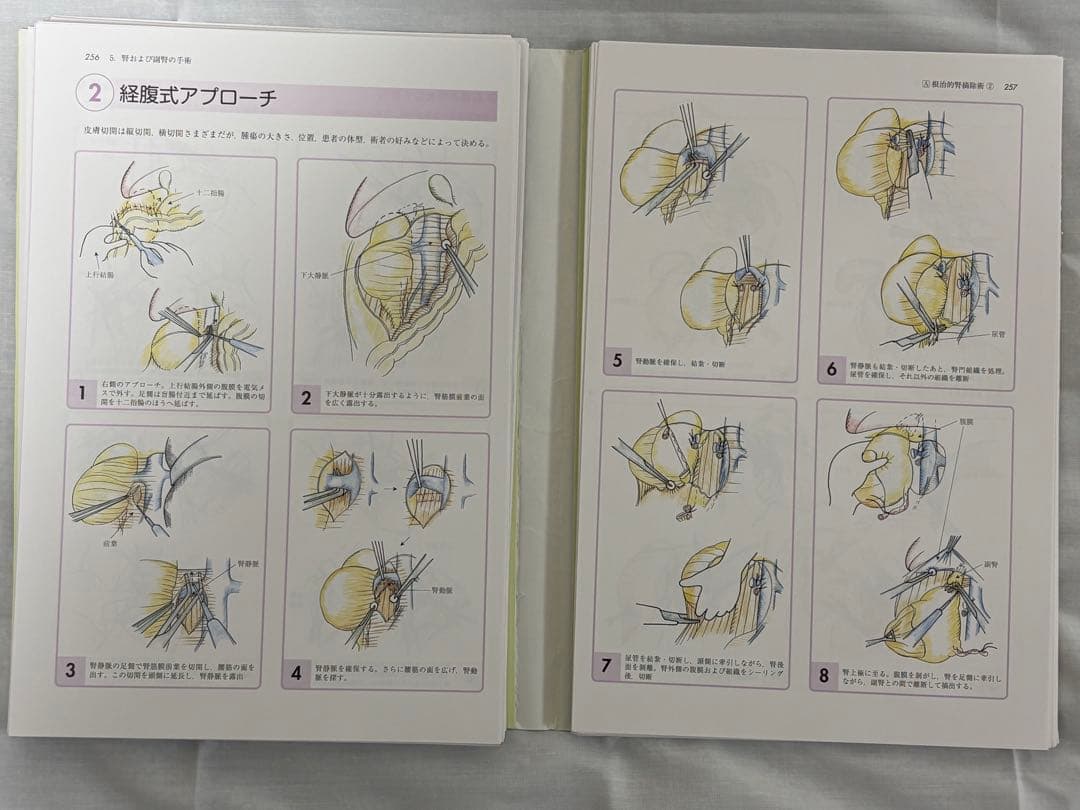 【裁断済】イラストレイテッド泌尿器科手術 第2集 図脳で学ぶ手術の秘訣