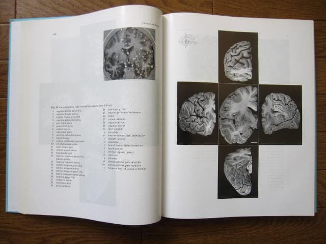 洋書 Duvernoy The Human Brain Second edition