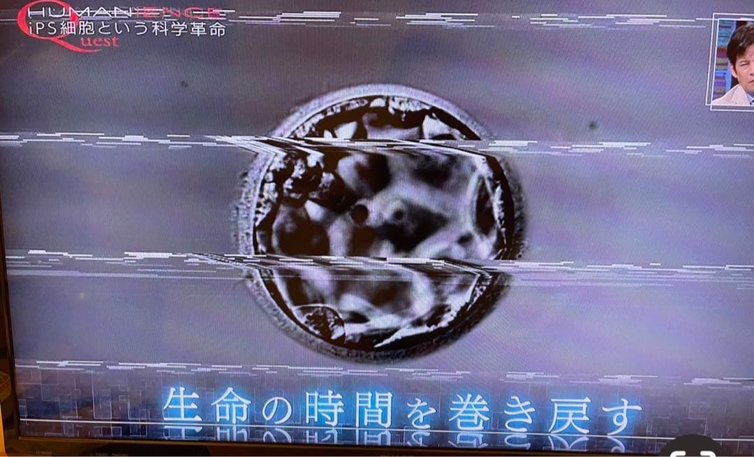 20%off IPS幹細胞培養液美容液35mg