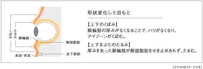 B.Aアイゾーンクリーム