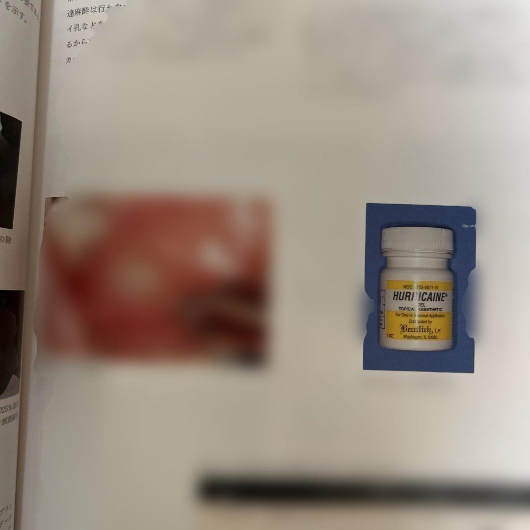 【希少】POI-EX SYSTEMの臨床 2006年版