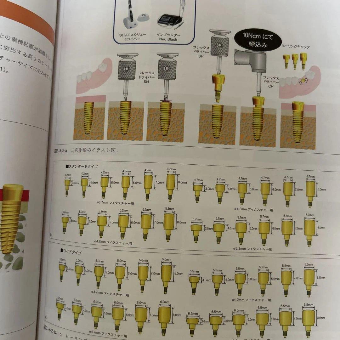 【希少】POI-EX SYSTEMの臨床 2006年版