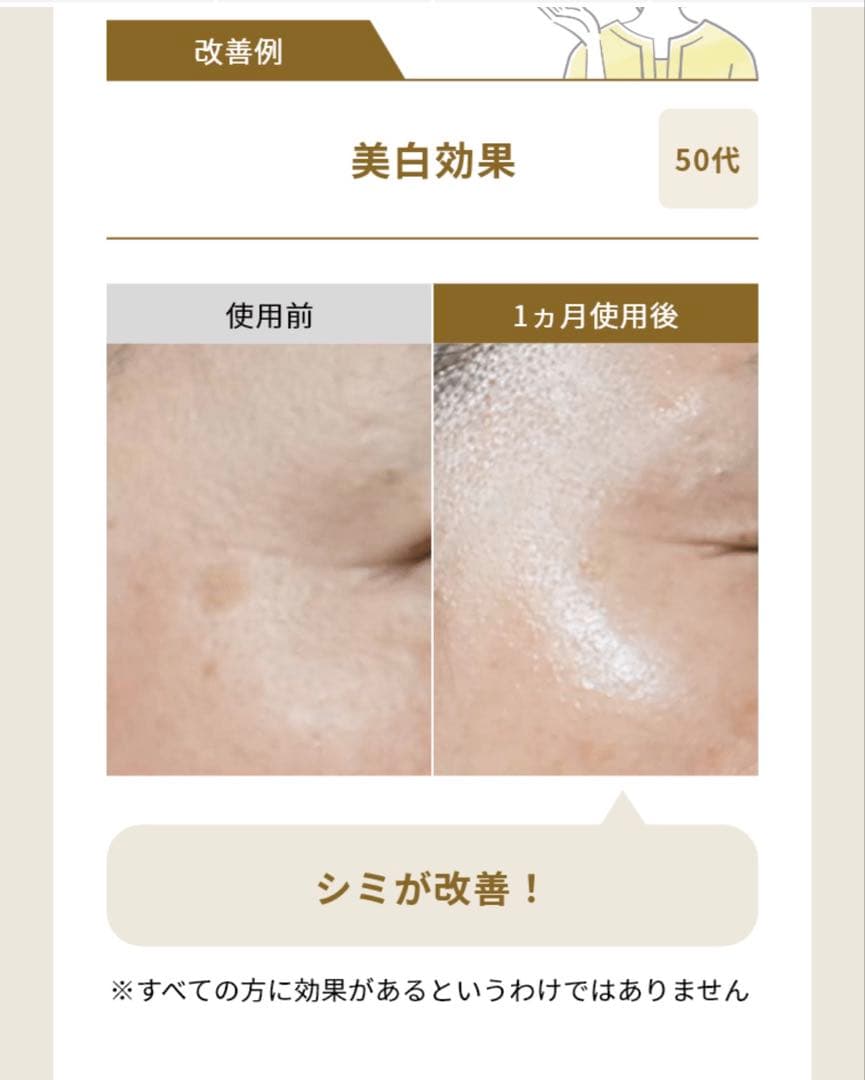 【最終価格・残り2点】新品ナリスSELGRACE I+II セット*2最高峰エイ