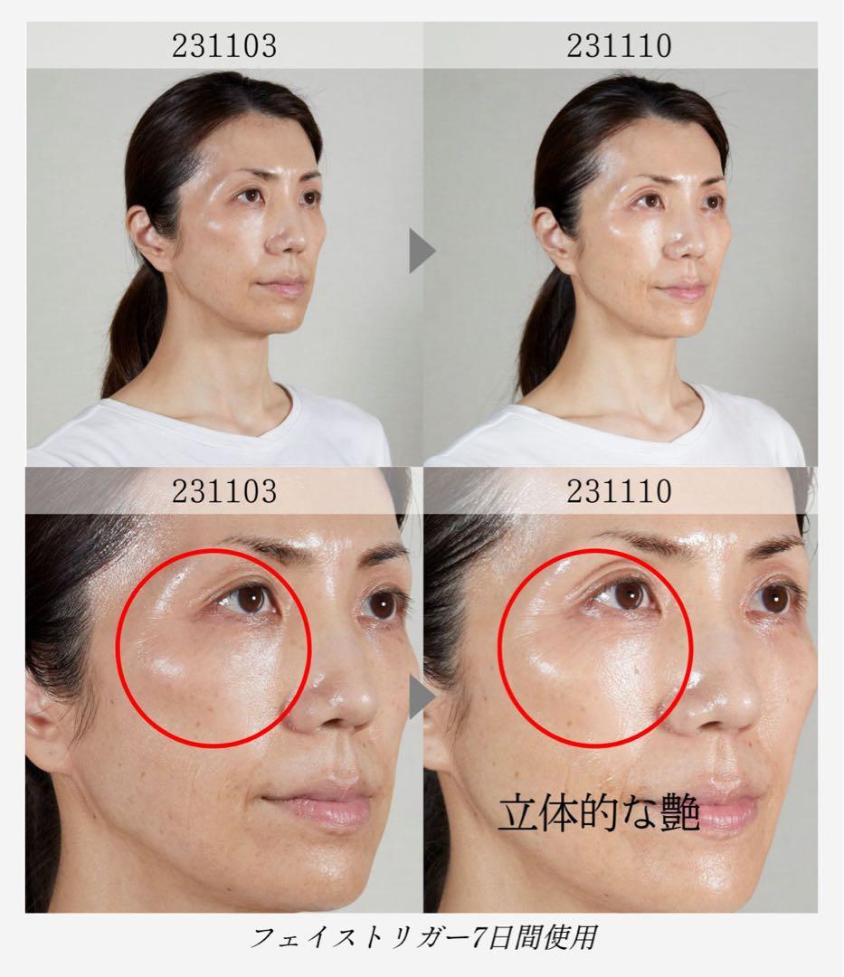 【新品未使用、未開封】コアフィット　フェイストリガー