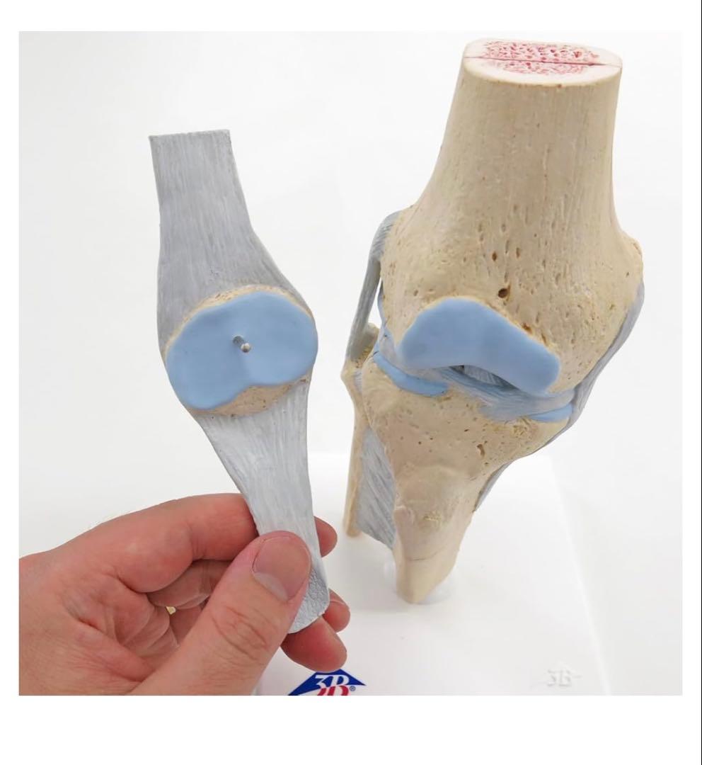膝関節模型 3B 膝関節断面モデル