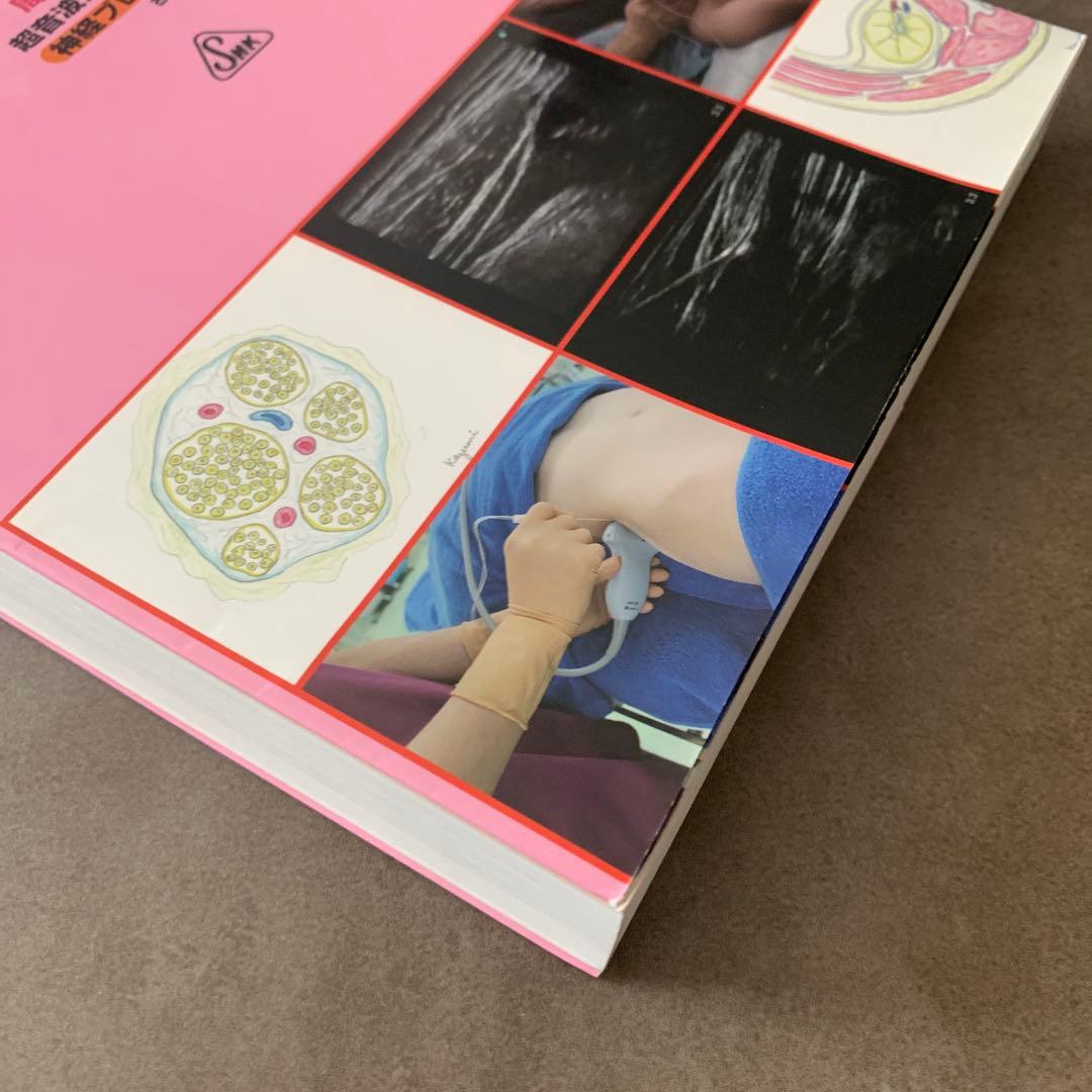 周術期超音波ガイド下神経ブロック