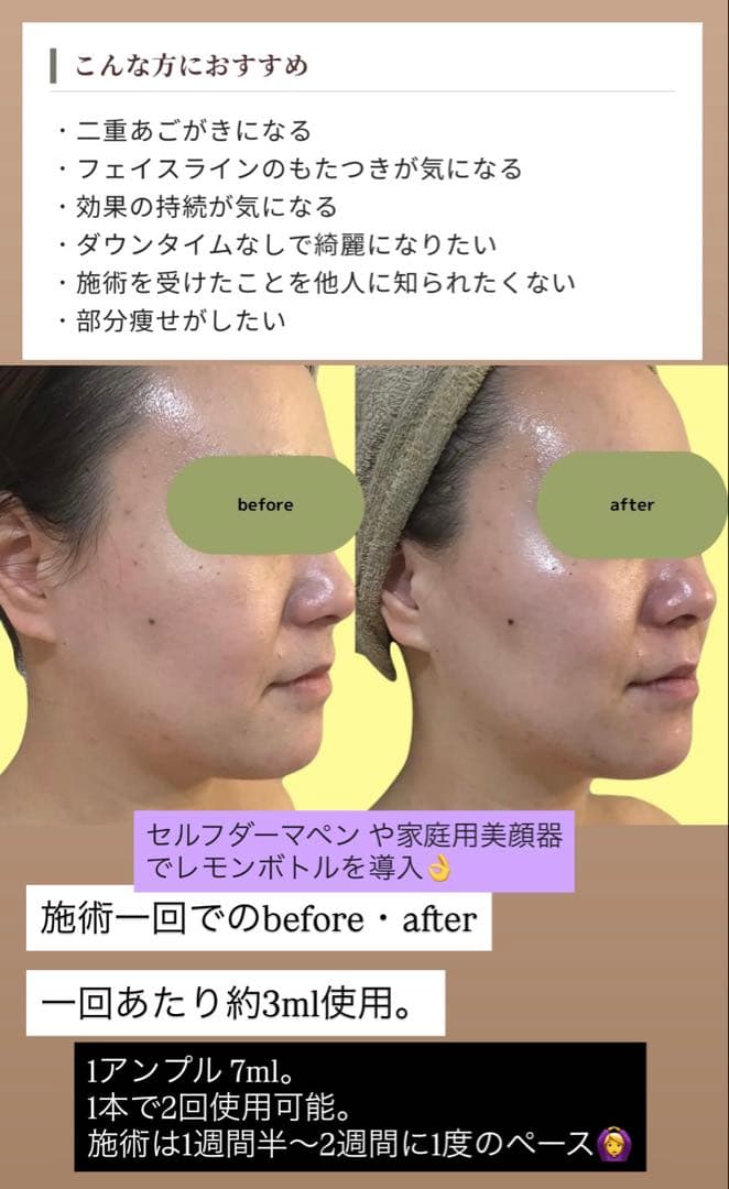 ECmama☆　レモンボトル×2本