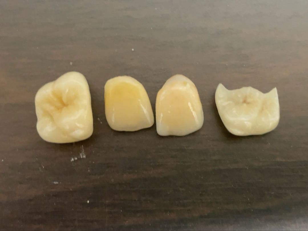 歯科技工　イーマックスサンプル模型　65116 歯科医院などのサンプルに！