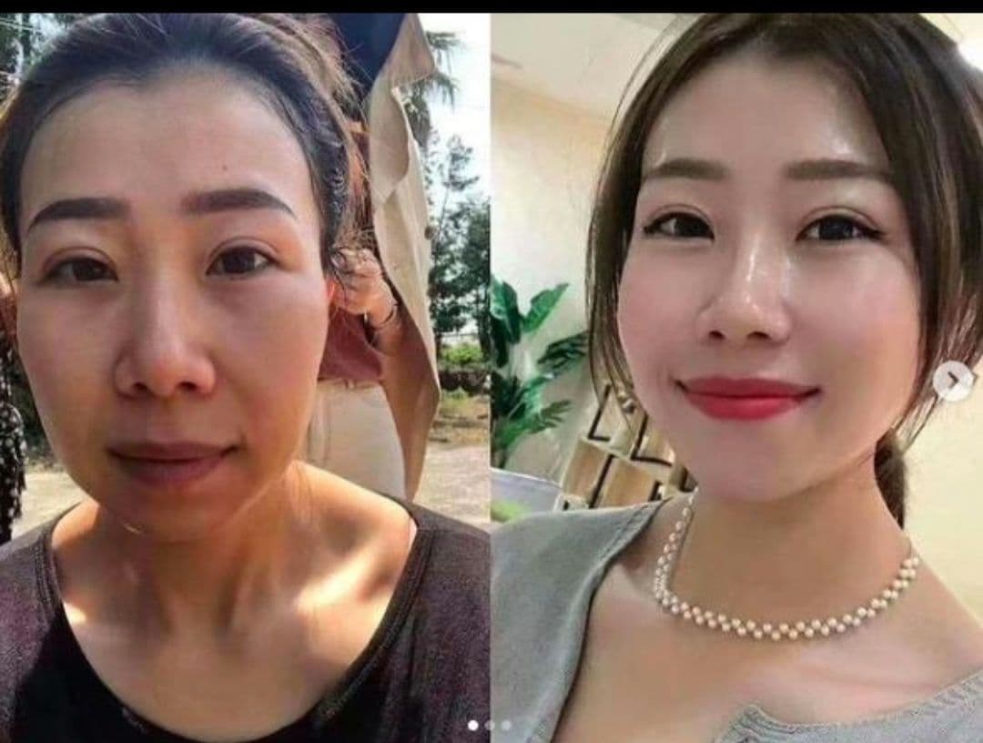 RENECELL ルネセル　基礎6点セット