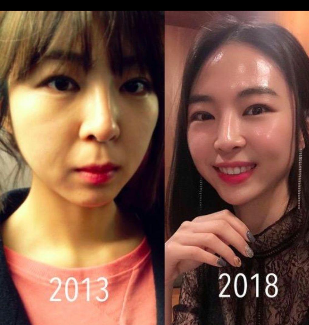 RENECELL ルネセル　基礎6点セット