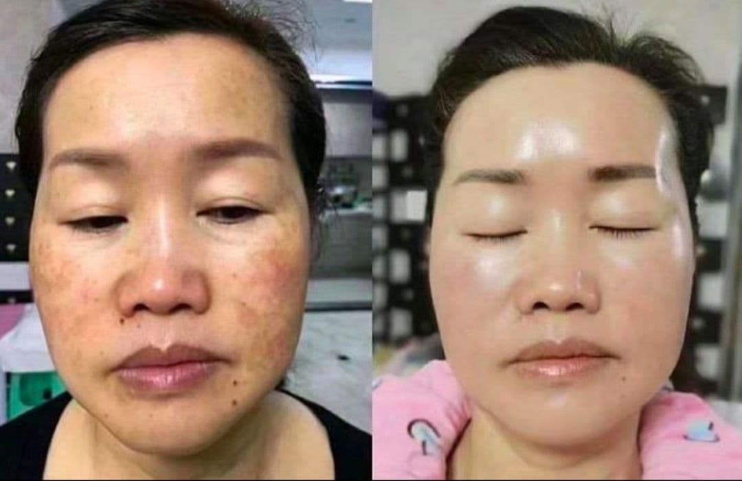 RENECELL ルネセル　基礎6点セット