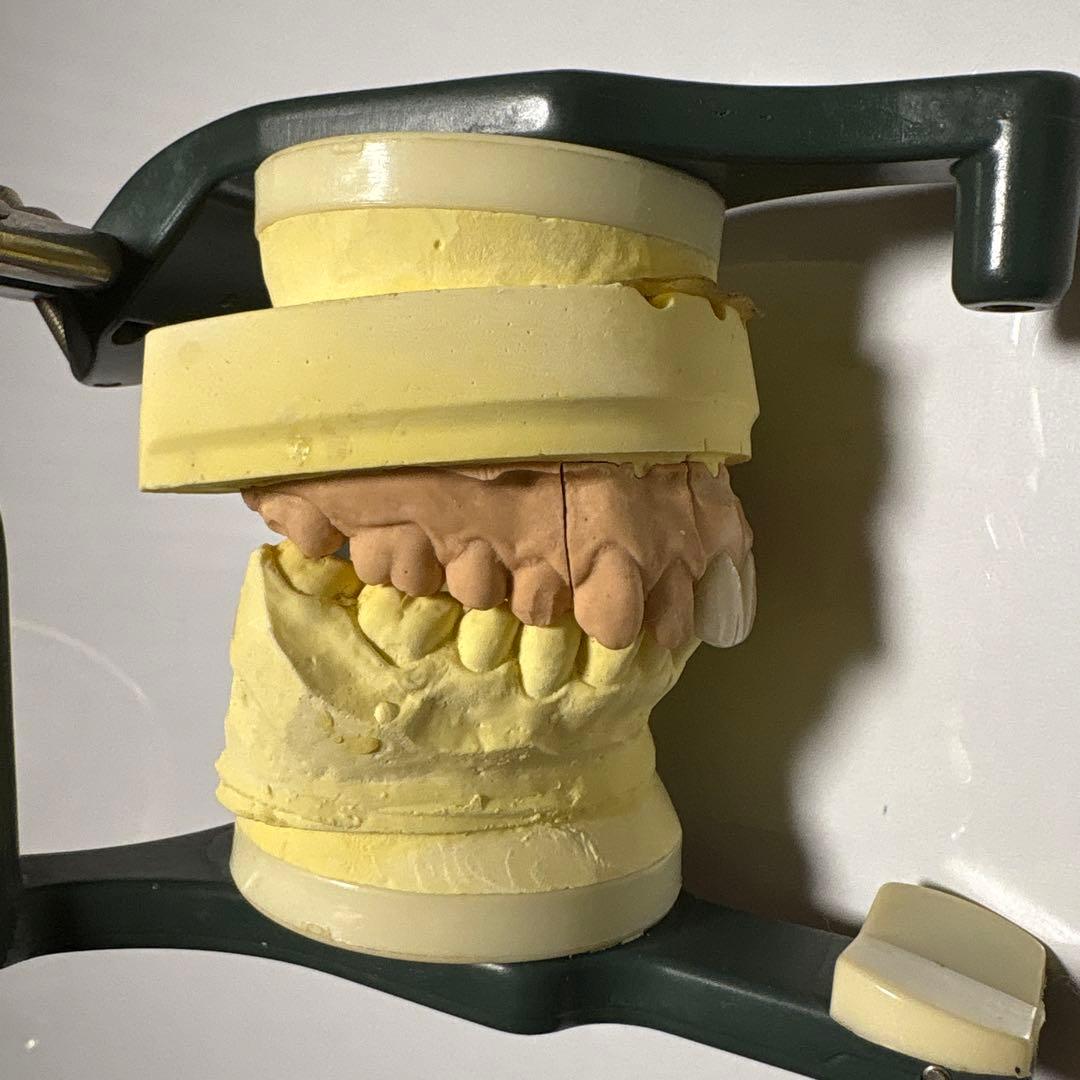 LABOMATE II 咬合器付きメタルボンド