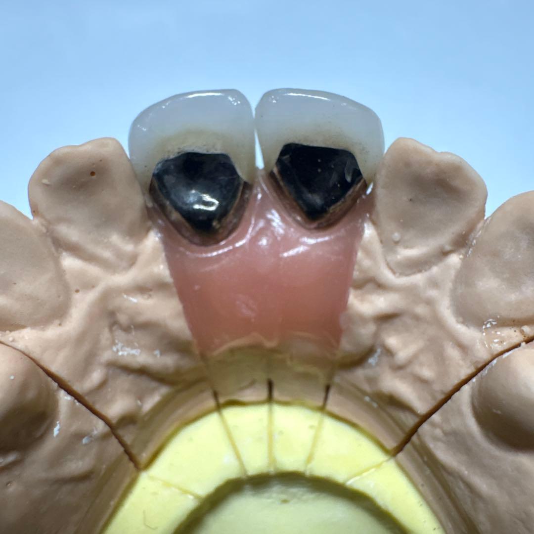 LABOMATE II 咬合器付きメタルボンド