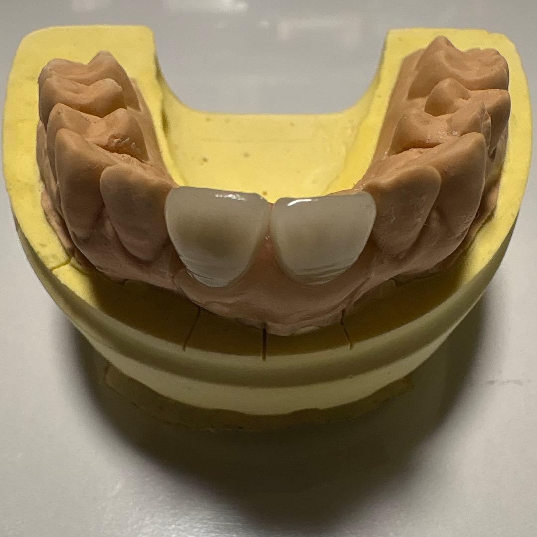 LABOMATE II 咬合器付きメタルボンド